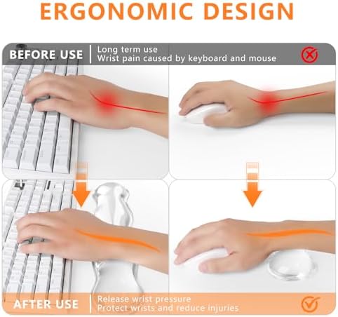 Gel Keyboard Wrist Rest, Cute Wrist Support and Arm Support Keyboard Rest for Keyboard and Mouse Typing Pain Relief，Suitable for Office/Computer/Laptop/Gaming（Transparent White Set ） - Image 2