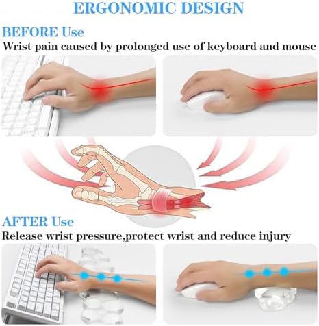 Acrylic Transparent Computer Keyboard Stand with Gel Cloud Keyboard and Mouse Wrist Rest, Ergonomic Tilting 3-in-1 Set, Relieves Painful Typing, for Office/Computer/Laptop/Gaming - Image 3