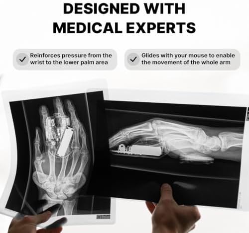 DELTAHUB Carpio 2.0 - Right-Handed Truly Ergonomic Wrist Rest for Mouse, Carpal Tunnel Support, Pain Relief, Anti-Fatigue, Easy Glide, Sleek, Office, Computer, Laptop, Gaming - Large, Black - Image 4