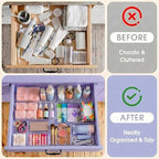 16 Pcs Extendable Clear Drawer Organizer|2-Size Expandable Drawer Dividers - Image 6