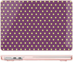 May Chen for M5/M4/M3/M2 MacBook Air 15 inch Case 2026-2022 - MC023 - Image 3
